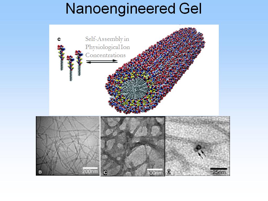 Nanoengineered Gel