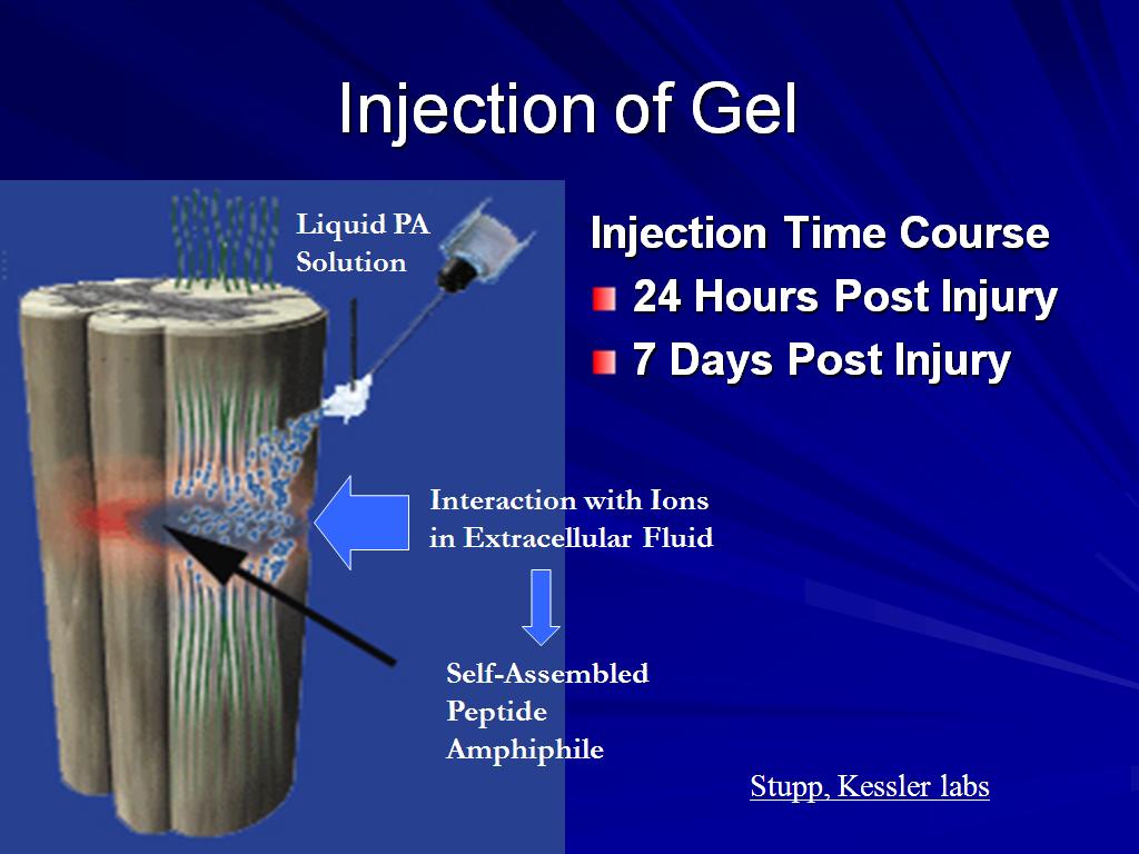Injection of Gel
